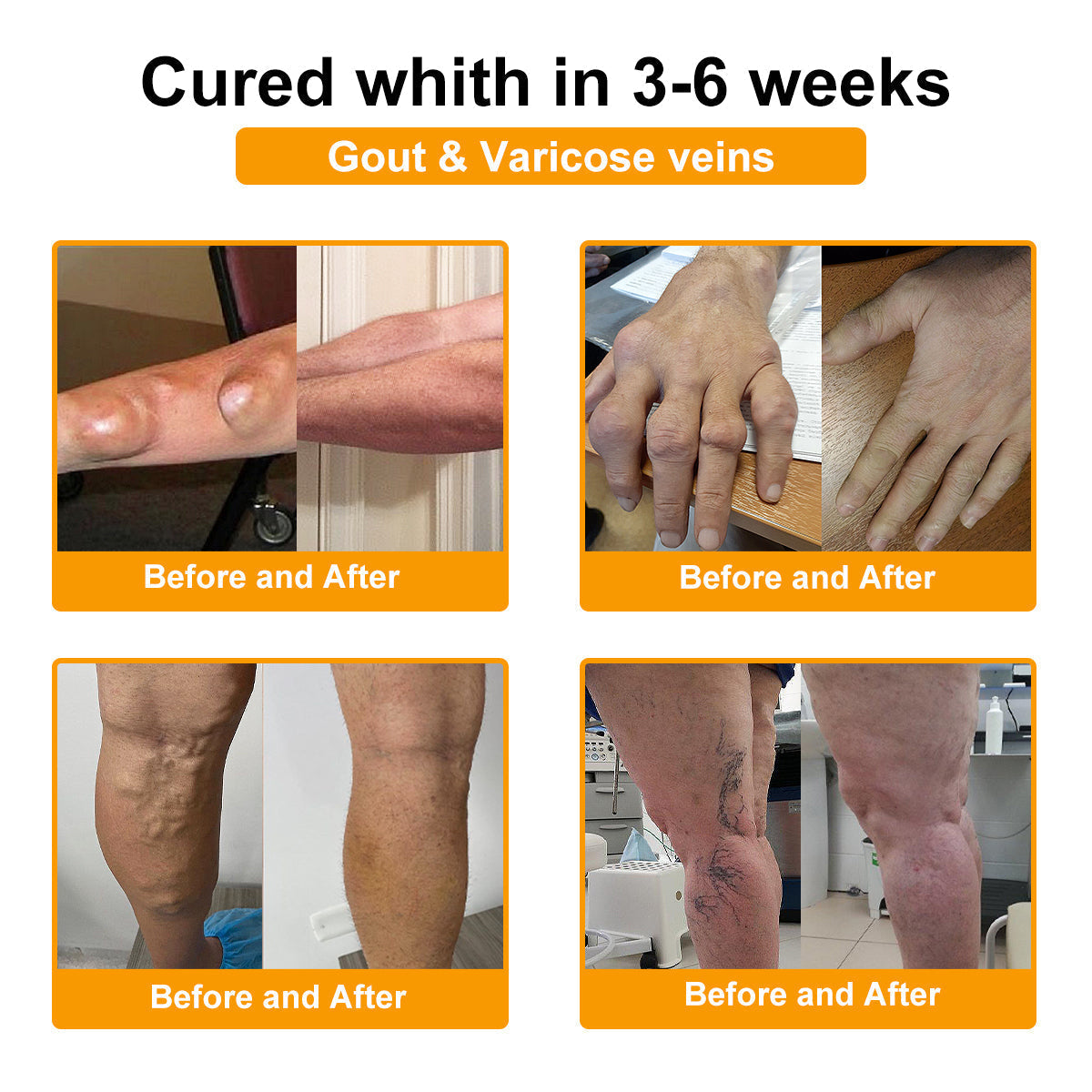 Lotmay® Bee Venom Analgesic Bone Repair Cream(👨⚕️Developed for the elderly,AOA Certification)