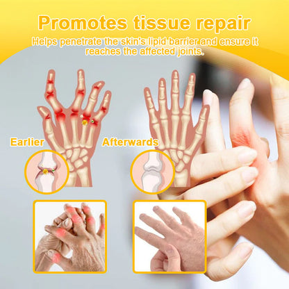 Lotmay® Bee Venom Analgesic Bone Repair Cream(👨‍⚕️Developed for the elderly,AOA Certification)