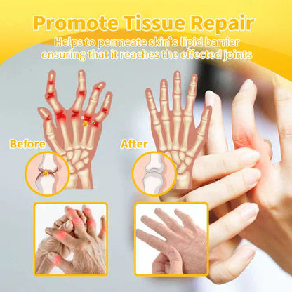 Lotmay® Bee Venom Pain Relief Joint Repair Cream 🐝🐝(Specially for older adults & AOA commends)