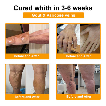 Lotmay® Bee Venom Analgesic Bone Repair Cream(👨‍⚕️Developed for the elderly,AOA Certification)