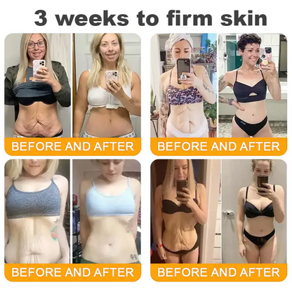 Lotmay® 𝘽𝙀𝙀 𝙑𝙀𝙉𝙊𝙈 𝑺𝒌𝒊𝒏 𝑹𝒆𝒔𝒕𝒐𝒓𝒂𝒕𝒊𝒐𝒏 𝑪𝒓𝒆𝒂𝒎 –🌸 Anti-aging,Hydrating, Skin Repair, Even Tone, Acne and Dark Spot Treatment, Wart and Mole Removal, Psoriasis Relief