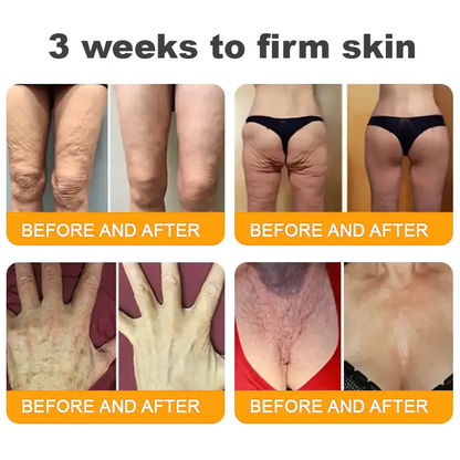 Lotmay® 𝘽𝙀𝙀 𝙑𝙀𝙉𝙊𝙈 𝑺𝒌𝒊𝒏 𝑹𝒆𝒔𝒕𝒐𝒓𝒂𝒕𝒊𝒐𝒏 𝑪𝒓𝒆𝒂𝒎 –🌸 Anti-aging,Hydrating, Skin Repair, Even Tone, Acne and Dark Spot Treatment, Wart and Mole Removal, Psoriasis Relief