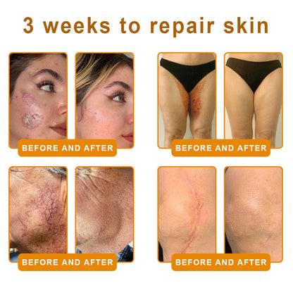 Lotmay® 𝘽𝙀𝙀 𝙑𝙀𝙉𝙊𝙈 𝑺𝒌𝒊𝒏 𝑹𝒆𝒔𝒕𝒐𝒓𝒂𝒕𝒊𝒐𝒏 𝑪𝒓𝒆𝒂𝒎 –🌸 Anti-aging,Hydrating, Skin Repair, Even Tone, Acne and Dark Spot Treatment, Wart and Mole Removal, Psoriasis Relief