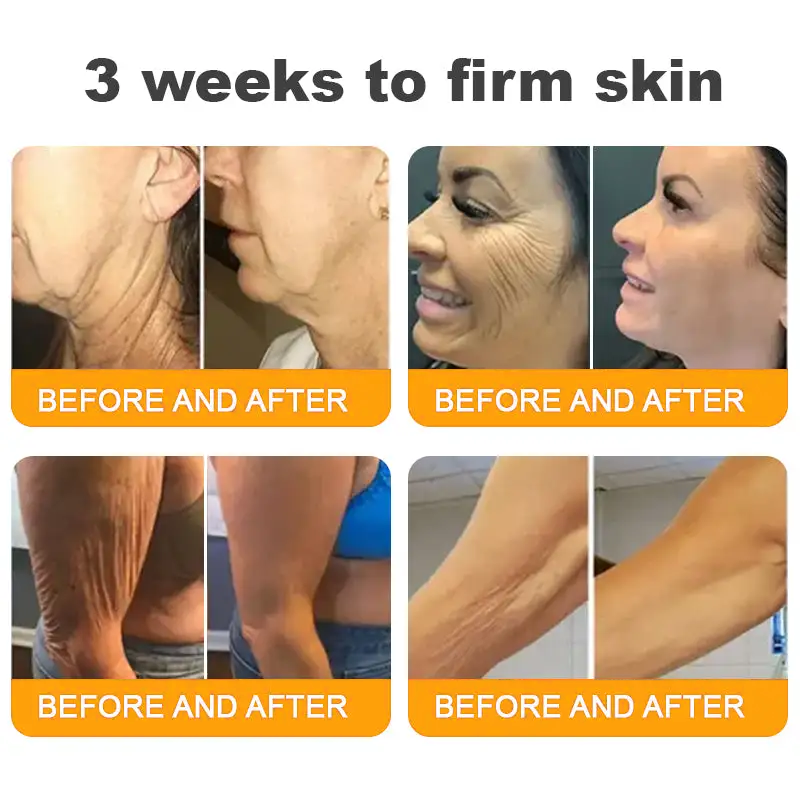 Lotmay® 𝘽𝙀𝙀 𝙑𝙀𝙉𝙊𝙈 𝑺𝒌𝒊𝒏 𝑹𝒆𝒔𝒕𝒐𝒓𝒂𝒕𝒊𝒐𝒏 𝑪𝒓𝒆𝒂𝒎 –🌸 Anti-aging,Hydrating, Skin Repair, Even Tone, Acne and Dark Spot Treatment, Wart and Mole Removal, Psoriasis Relief