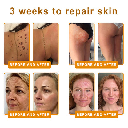 Lotmay® 𝘽𝙀𝙀 𝙑𝙀𝙉𝙊𝙈 𝑺𝒌𝒊𝒏 𝑹𝒆𝒔𝒕𝒐𝒓𝒂𝒕𝒊𝒐𝒏 𝑪𝒓𝒆𝒂𝒎 –🌸 Anti-aging,Hydrating, Skin Repair, Even Tone, Acne and Dark Spot Treatment, Wart and Mole Removal, Psoriasis Relief