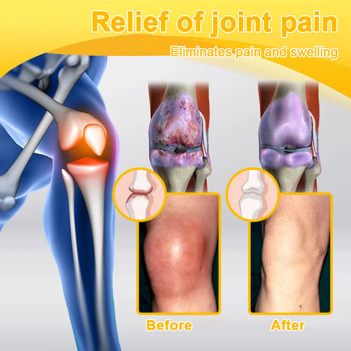 Lotmay® Bee Venom Analgesic Bone Repair Cream(👨‍⚕️Developed for the elderly,AOA Certification)